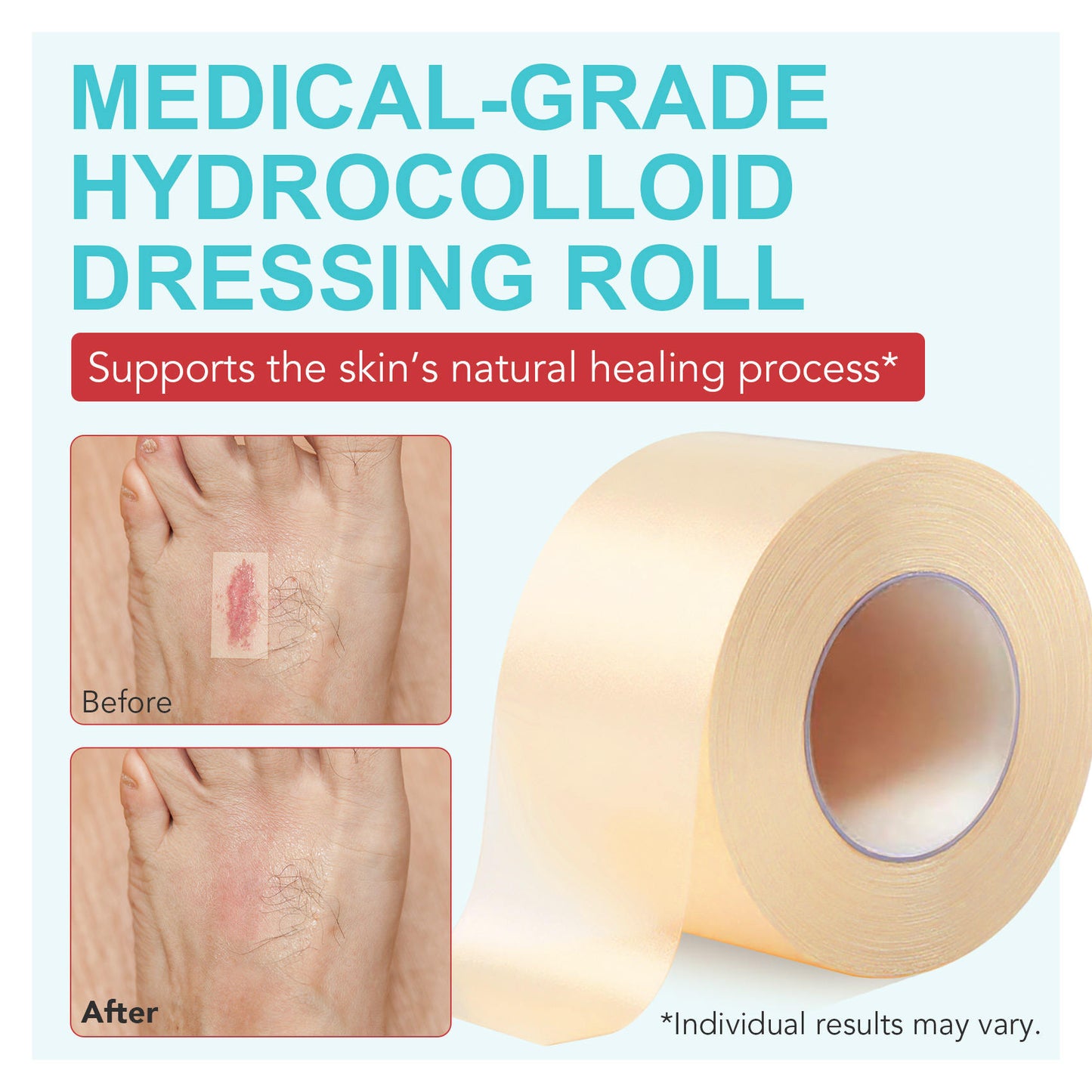 ShobKisu Bd - Hydrocolloid Medical Grade Tape Acne Patch, Blister Bandage & Scars Care.