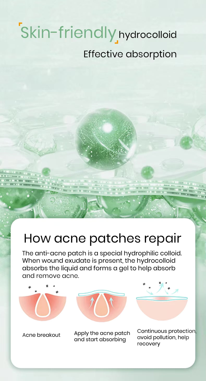 Hydrocolloid Acne Patches – Invisible Pimple Patch for Fast Healing & Scar Prevention.
