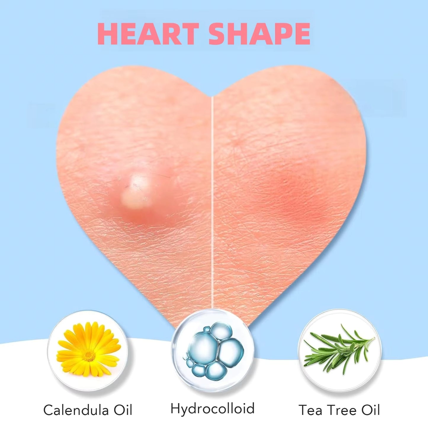Microdarts Tag Gone Patch – Remove Skin Tags, Warts, Moles & Oil Clogs.