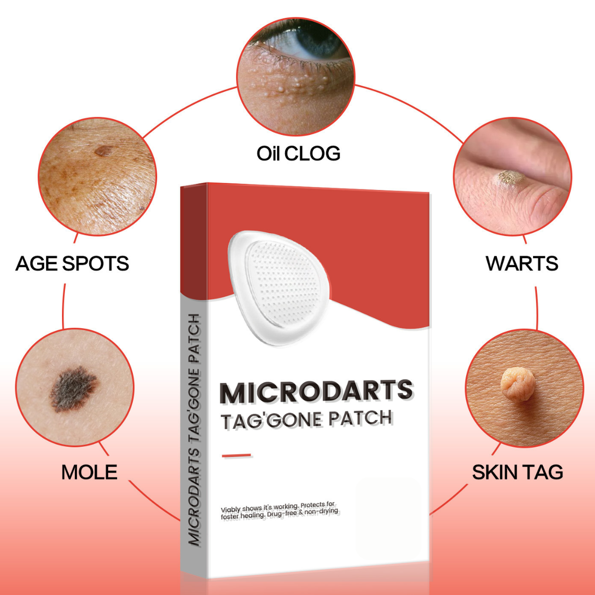 Microdarts Tag Gone Patch – Remove Skin Tags, Warts, Moles & Oil Clogs.