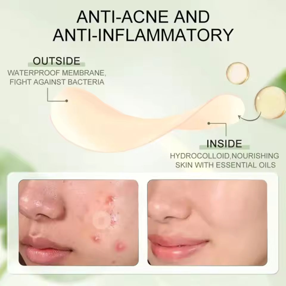 Hydrocolloid Acne Patches – Invisible Pimple Patch for Fast Healing & Scar Prevention.