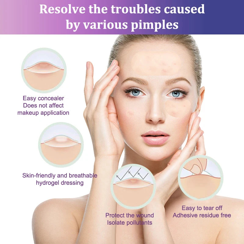 Hydrocolloid Acne Patches – Invisible Pimple Patch for Fast Healing & Scar Prevention.